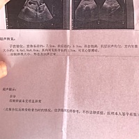 有懂的知道是男孩还是女孩吗？