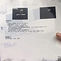 猜猜是儿是女？…37周哈哈5斤不到，吃的都长哪里去咯！