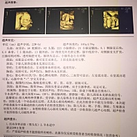 各位亲们谁能告诉我是男孩还是女孩啊？？？