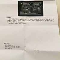 这样的可以看出男宝还是女宝吗？请问怎么分辨呢😊