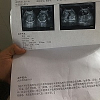 谁会看吗？求大仙看看，好好奇是男孩还是女孩呀