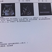 亲们，可以看看是男宝宝还是女宝宝吗，今天做的nt