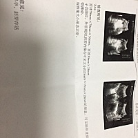 3.10号第一次检查，医生说有50天了，和我算的时间有差异，有会看的宝妈吗？二胎，年纪36岁了，不想时间...