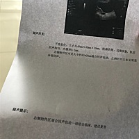 今天去做的孕前检查，做完B超之后显示右侧有包块，有没有人知道怎么回事的，医生让我三个月后来完例假再...