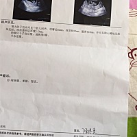 NT数据真的可以看性别吗？