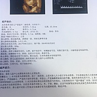 大家能帮我看看是男宝还是女宝呢！