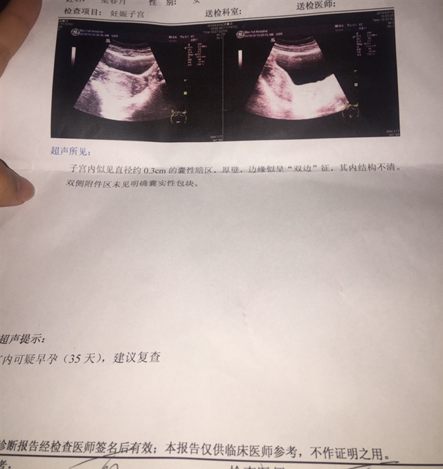 这是第一次检查时做的b超，什么也看不出来。