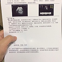 刚出的报告，有没有大神能知道男女啊，  😏反正我知道了！