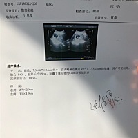 孕囊能看男女吗，求大神指导 哈哈