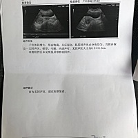 这样有没有事呀 超担心 心里都打哆嗦 第一次怀孕 六周了啥都没有 医生开胞胎丸 孕酮片 还有维生素 下周...