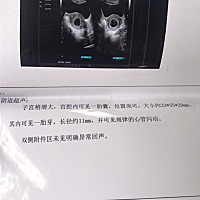 男宝宝还是女宝宝呢？