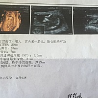 男宝还是女宝，大家帮我看看，求解。懂得人看看。