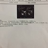 热腾腾的胎心胎芽来了，之前没照到一直担心会不会有什么问题，今天复查一切顺利，从十号开始就呕吐的厉...