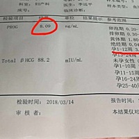 很想当妈妈，两次报告不给力，孕囊没验出来也不知是宫外宫内，怎么回事呢？我1.21经末，2.24号后同房（...