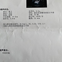 36周是不是偏小啊