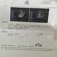 看男女，求解。