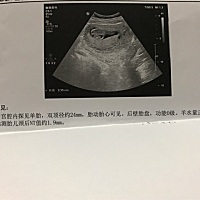 会看的帮忙看看男女，直觉告诉我绝对是男孩没错了…………😢😢😢二胎了，一胎也是男宝，女儿梦又...