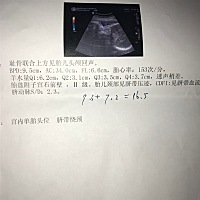 谁能看懂孩子几斤