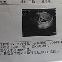 圈里大神们帮看看是男宝女宝 😘