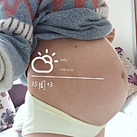 35周 3帮忙看下男宝还是女宝