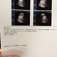 有没有宝妈能看出来这是男还是女