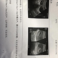 有没有会孕囊看男女的，一胎，比较好奇！45天 5周的时候。