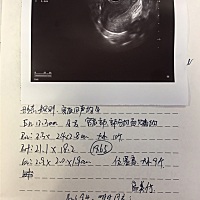 刚去医院测的排卵，b超报告医生也没对我讲解，只是让我今明同房，有没有懂得朋友帮忙介绍下这个报告讲的...
