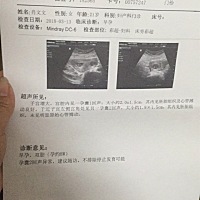 双胞胎六周的时候都有胎芽胎心，过后阴道出血特别少，没有鲜红色，褐色的，去医院有一个没有胎芽胎心了...