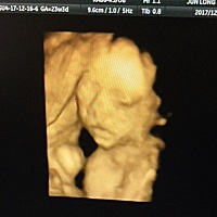 下个月就要生了，不管是男是女，只希望自己生个健康漂亮的宝宝，老天保佑。