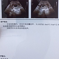 还是没有胎心胎芽怎么办。现在天天吐的要死掉了。怎么办