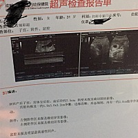 终于B超了，本想着建卡在去的，诸多原因没等到一起去完成，好好奇，你是男宝还是女宝🤗🤗🤗？？？