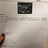 请问亲们这是怎么回事，医生居然说不敢保证是正常的～担心坏了