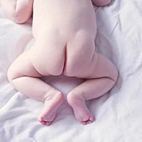 这是正常新生儿屁股的样子吗？？