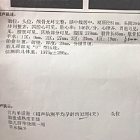 孕34周 羊水只有66MM 医生建议住院 可以不住吗 宝妈们有没有和我情况类似的