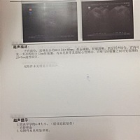 大家帮我看看，这正常吗