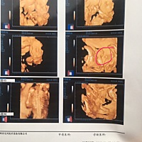 医生这是在告诉我是男孩子吗？