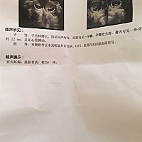 怀孕8周，能辨別出性别吗？