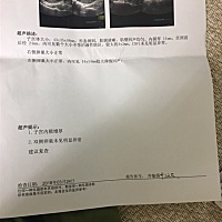 大家好，我准备开始备孕，做了孕前体检，显示的子宫内膜增厚，检查的这天正好是排卵期，请问这个能怀孕...