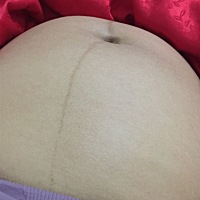 八个月肚子都丑歪了 脖子还这么黑的纹 🤣🤣🤣