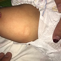 问一下大家这是起了什么？