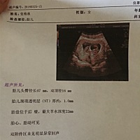 宝妈们，能看出来男孩女孩吗。