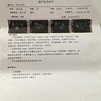 备孕前检查有子宫肌瘤 是先手术还是怀孕好啊 求有经验的人指点