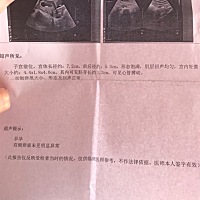 想知道是男孩还是女孩