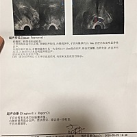 今天查到宫外孕，在“右侧卵巢旁”，孕酮降低,hcg缓慢增长。伤心哭了一天，感觉我的天要塌了。