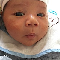 我们26天了ᵒ̴̶̷̤😊ᵒ̴̶̷̤不知道宝宝脸上长的小痘痘是啥٩😐ི۶