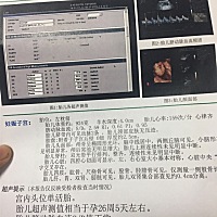 还有半个月生这是以前的检查来猜一下男女，到时候来验证！