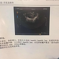 你们子宫形状啥样的