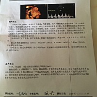 接好孕，宝宝健康。第一胎有点好奇是男孩还是女孩，谁看的懂？说一声谢谢