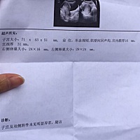 什么都没检查出来。我的天。那我最近都是干嘛了。