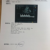 今天34周产检，医生说宝宝偏大，后面水果不要吃了，只能吃小番茄🍅黄瓜，还有脐带绕颈2圈心塞，好紧张...